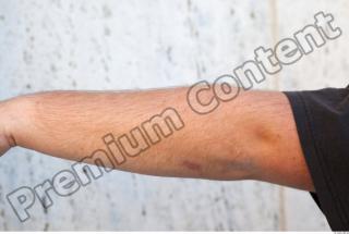 Forearm texture of street references 378 0001